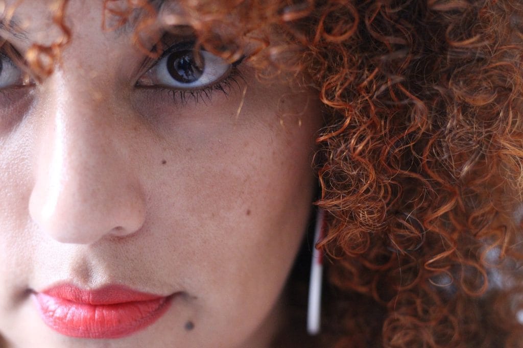 Tratamento de Melasma: Descubra o Segredo que Poucas Pessoas Conhecem